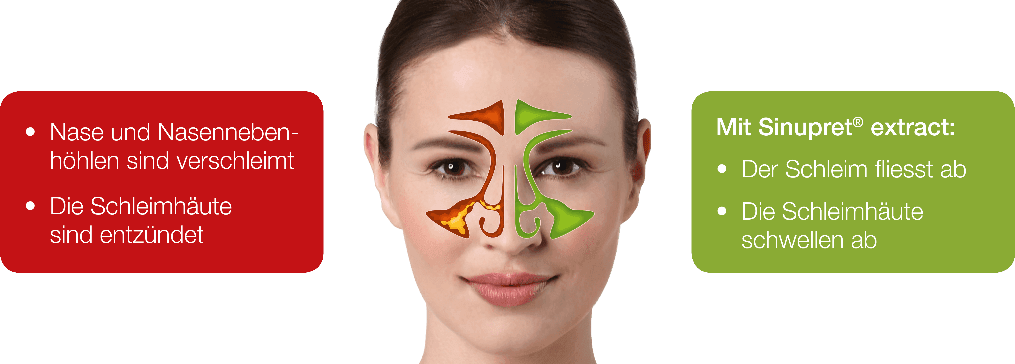 verschreibungspflichtige medikamente nasennebenhöhlenentzündung